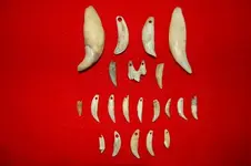 Drilled Teeth 1.webp