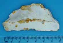 Neolithic Scraper 3.webp