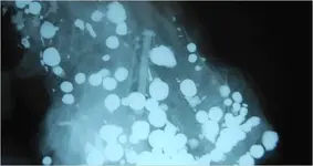 voodoo xray.webp