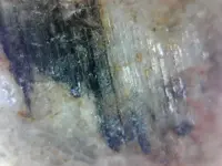 5 (2).webp