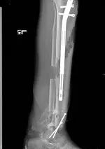 Xray.webp