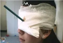 eye.webp