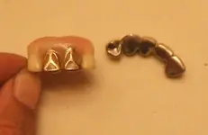 Teeth.webp