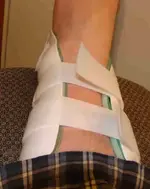 busted leg.webp