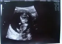 baby.webp