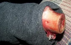 myarm.webp