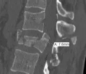 spine.webp