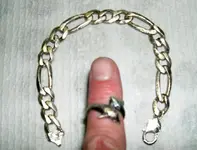 Harryringnbrace1.webp