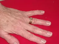 ring return 002.webp