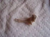 tooth.webp