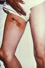 bite.webp