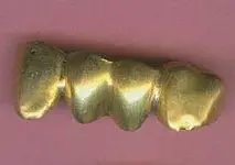 TEETH_3.webp