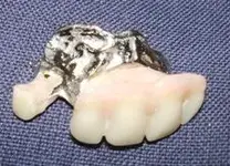 teeth.webp