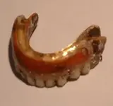 gold teeth.webp