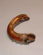 gold teeth1.webp