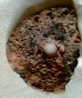 Image000.webp