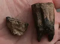 bi tooth 002.webp