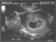 BABY CARL.webp