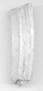 Front vertical scan of tooth.webp
