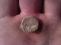 lead seal.webp