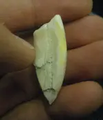 tooth2.webp