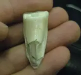 tooth3.webp
