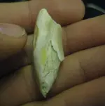 tooth4.webp