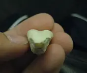 tooth5.webp