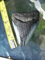 tooth 009.webp