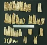teeth.webp