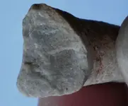 tooth3.webp