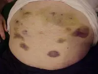 stomach1.webp