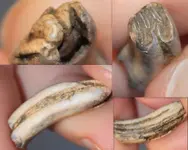 tooth1 (650x520).webp