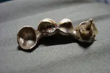 6_29_10 Teeth1.webp
