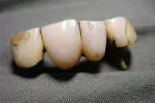 6_29_10 Teeth2.webp