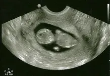 my baby.webp