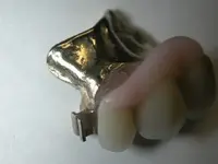 GoldPartial.webp