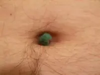 300px-navel_lint_ball[1].webp