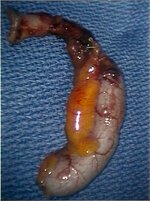 apendix.jpg