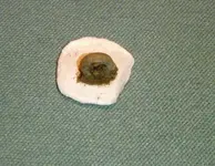 pearl button back.webp