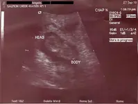 babyscan1.webp