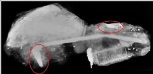 X-ray Pic 2.webp