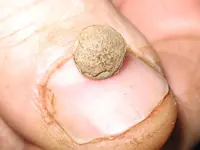 my tiny button 2.webp