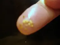 golden finger.webp