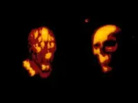 zombie n skull.webp