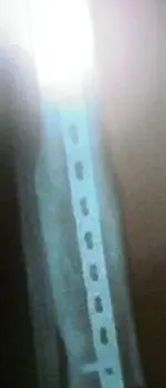 leg3 (260x606).webp
