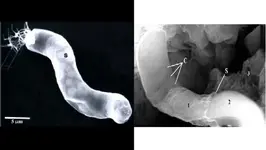 bacterium_1.webp