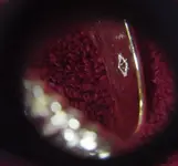 ring ladies hallmark.webp