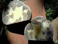 nodule3.webp