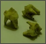 frangodtooth.webp